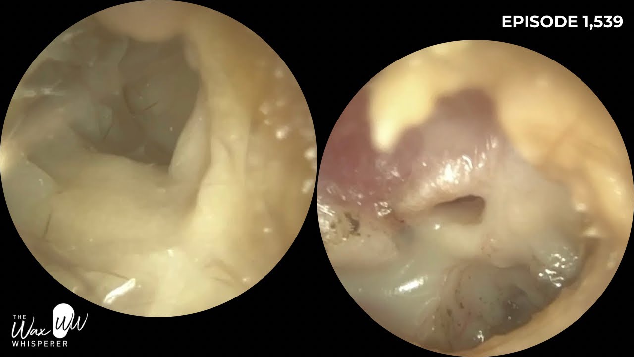1539 — Зуд в ухе? Обратитесь к врачу, аудиологу или ЛОРу.