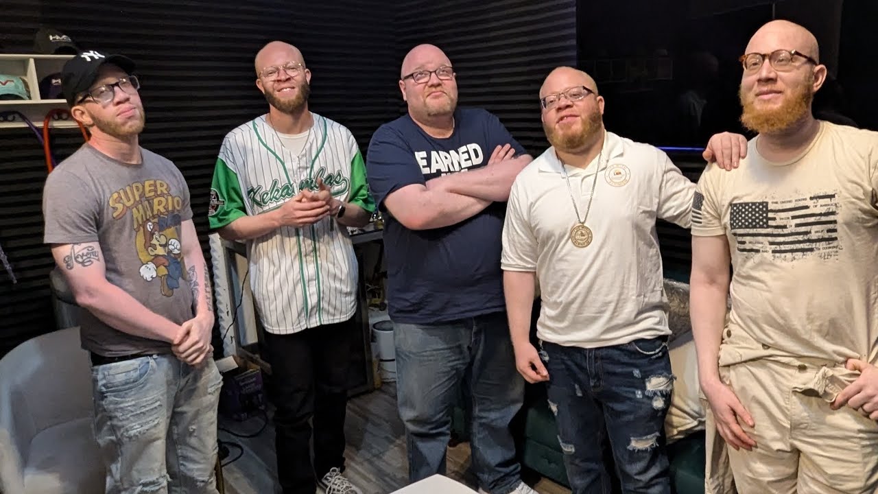 MEET GAVIN, LIFE WITH ALBINISM PODCAST