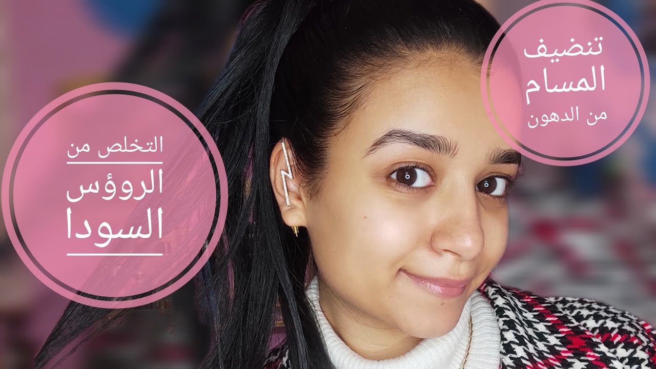 ازاله الروؤس السودا + تقليل افراز الدهون و تنضيف المسام تماما