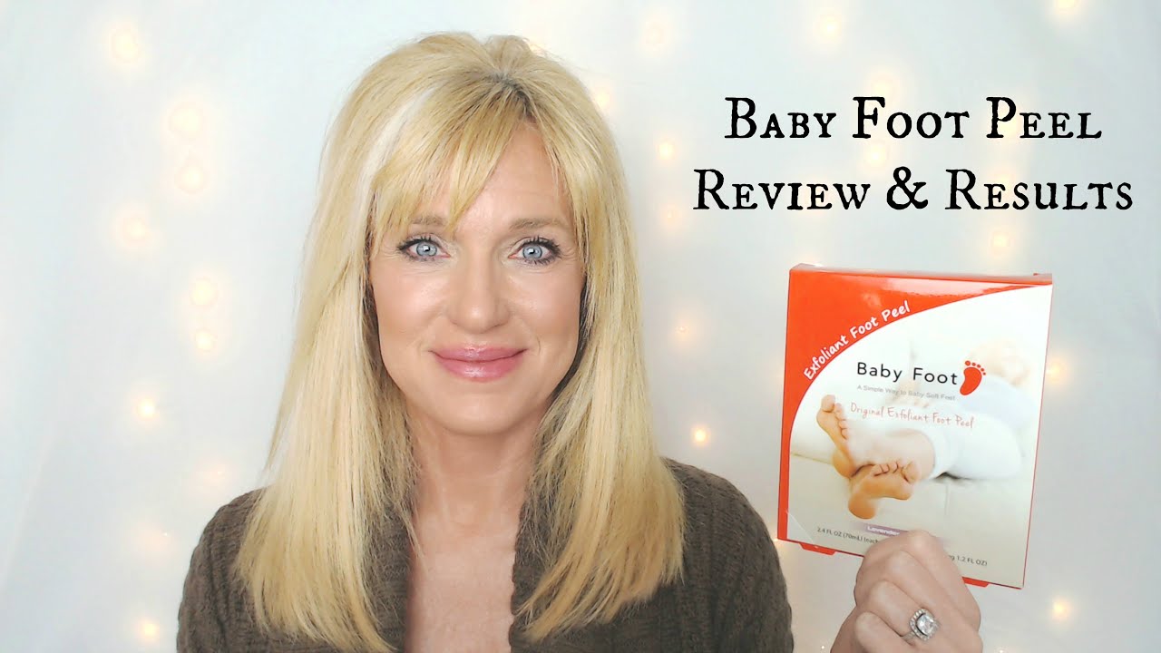 Baby Foot Peel Review & Results!