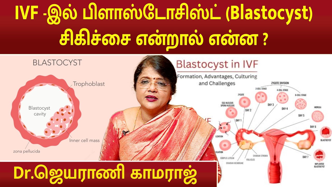 IVF -இல் பிளாஸ்டோசிஸ்ட் (Blastocyst) சிகிச்சை என்றால் என்ன ? | Dr.Jeyarani Kamaraj |