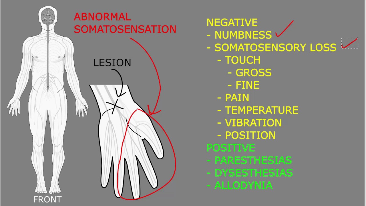 Somatosensory symptoms and signs