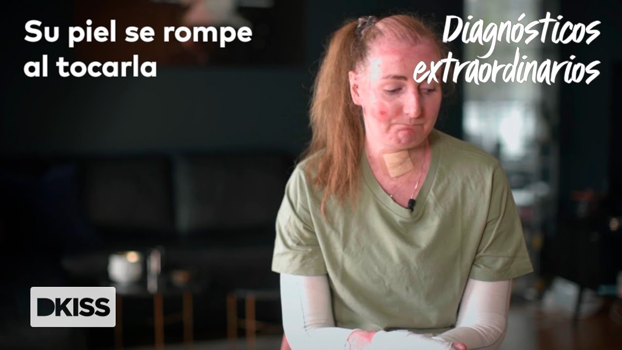 Tarda 4 horas al d&iacute;a en curarse | Diagn&oacute;sticos extraordinarios