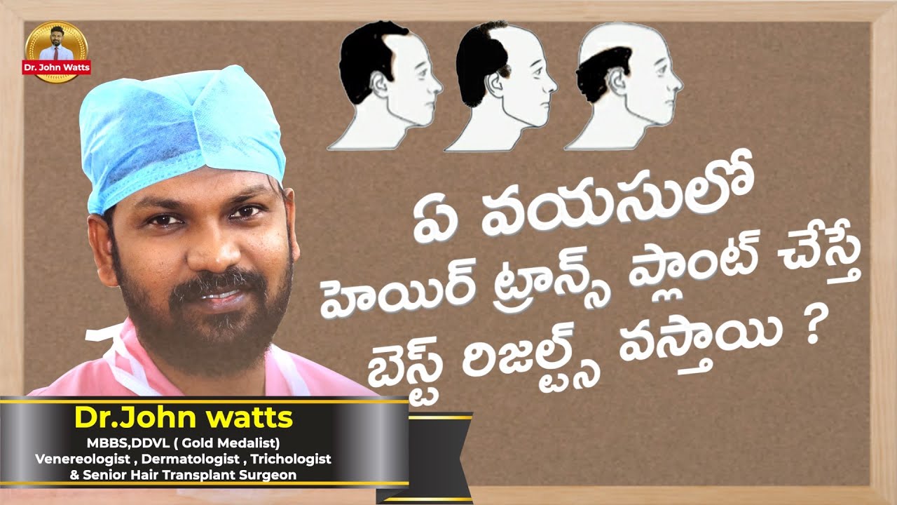 ఏ వయసులో హెయిర్ ట్రాన్స్ ప్లాంట్ చేస్తే బెస్ట్ రిజల్ట్స్ వస్తాయి | Dr. John Watts | TRICHOS