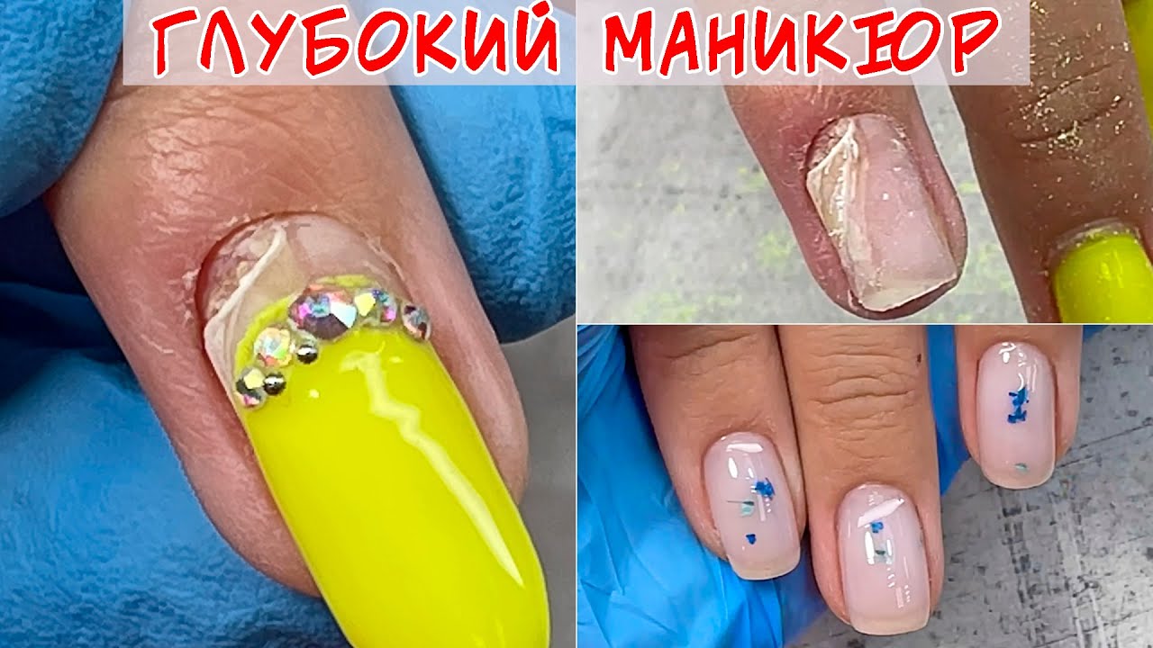 Дырка в ногте 😱 / Последствия глубокого маникюра