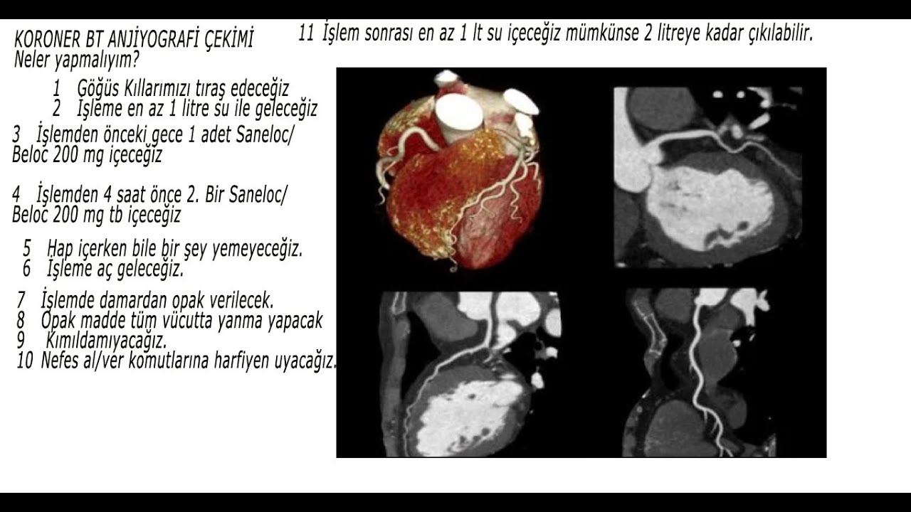 SANAL ANJİYOGRAFİ Koroner BT Anjiyografi Nasıl çekilir? nasıl hazırlanmalıyım