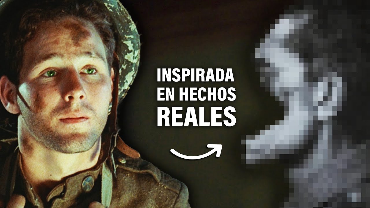 Por Una TRAGEDIA Se Queda Sin PIERNAS, BRAZOS Y CARA | Resumen: Johnny Tomó Su Fusil