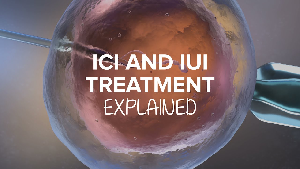 IUI & ICI EXPLAINED