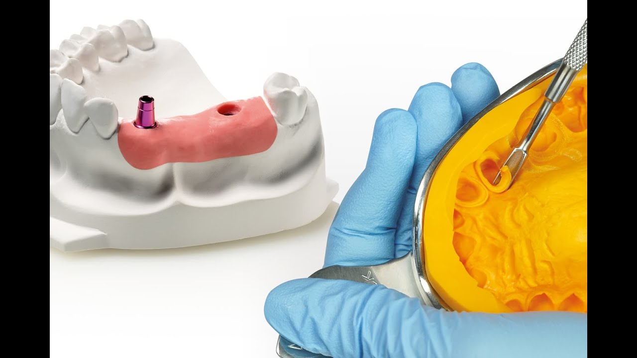 Elastic Impression Material / Hydrocolloids (Reversible and Irreversible) / Part 1