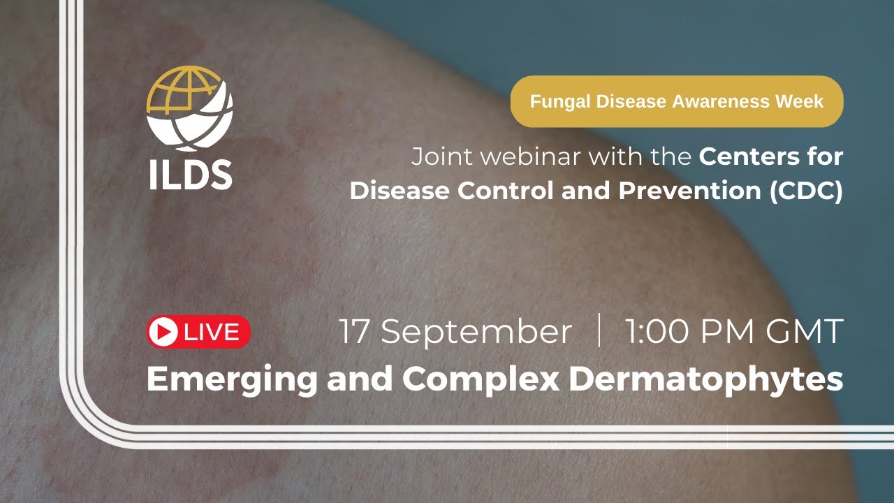 Emerging and Complex Dermatophytes - joint webinar by the ILDS and CDC