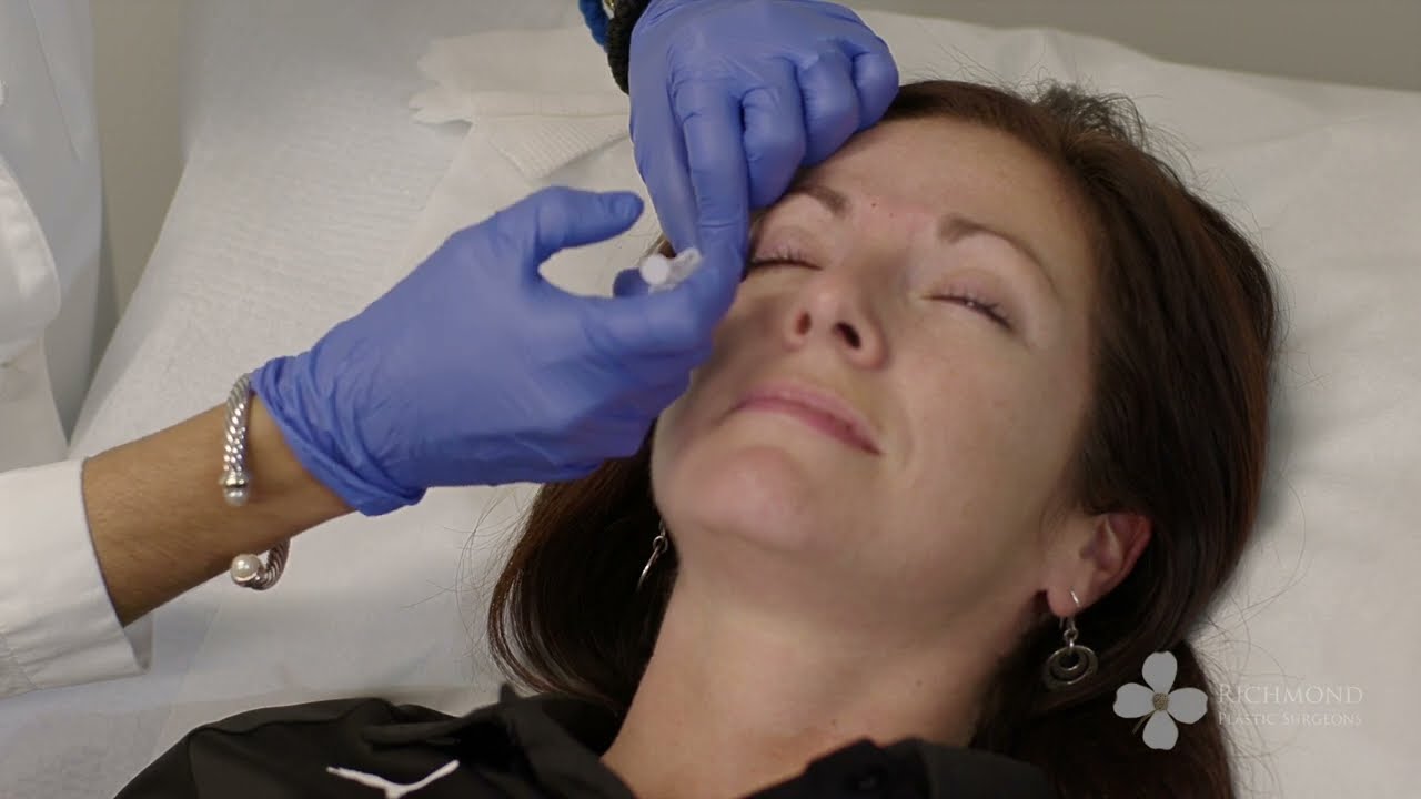 Dr. Aboutanos - Botox Demonstration