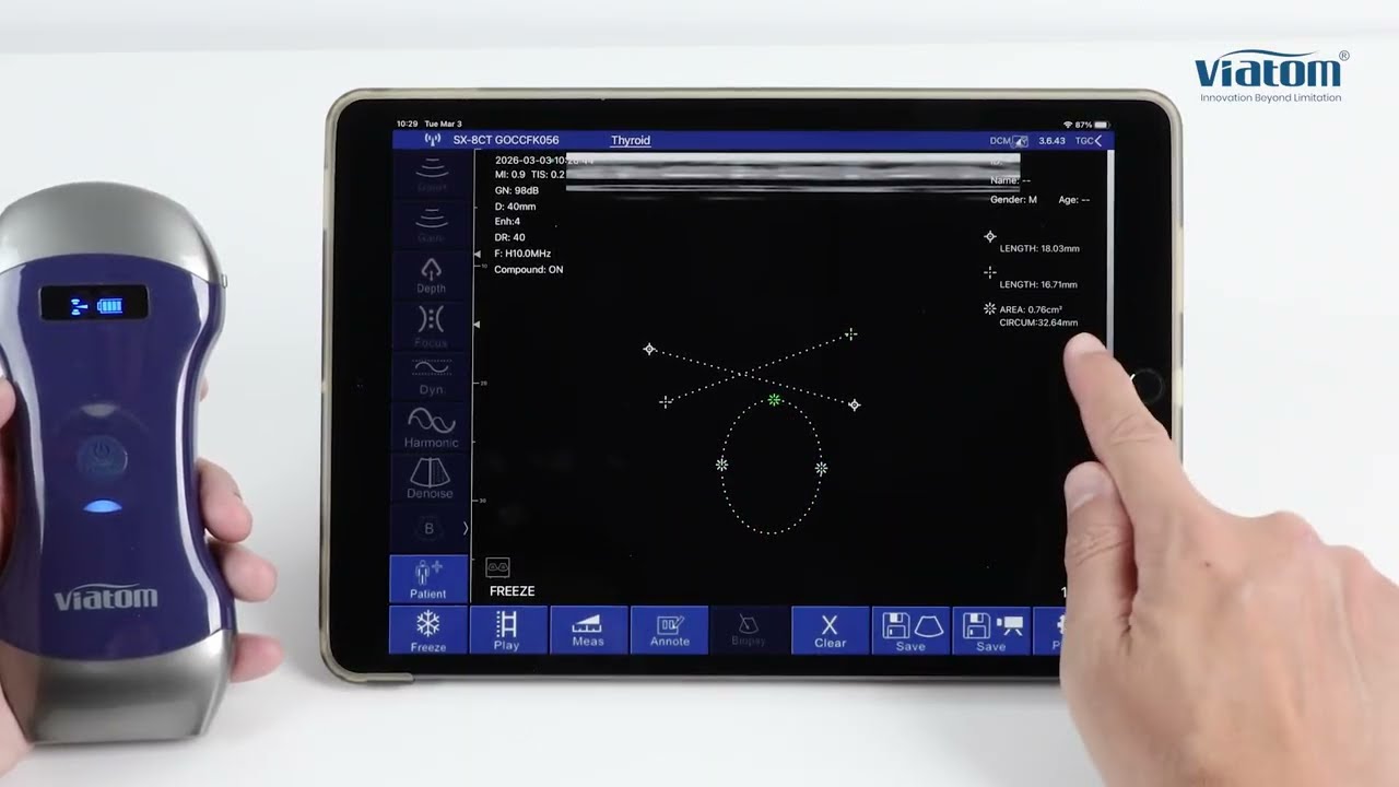 Software Guide | Viatom Pocket Ultrasound Software Demonstration