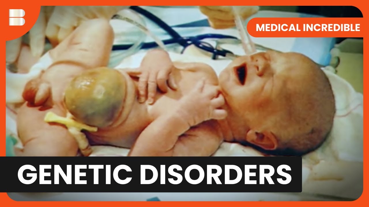 Defying Odds: Baby's Survival Story - Medical Incredible - Documentary