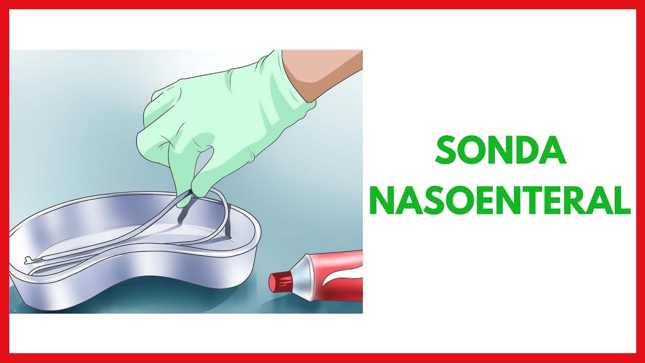 Sonda Nasoenteral e os Cuidados de Enfermagem