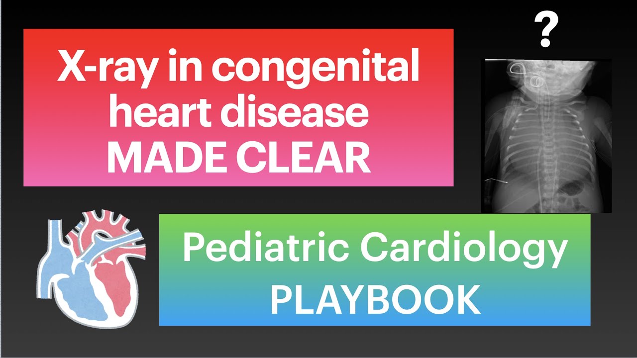 X-ray in congenital heart disease MADE CLEAR by Pediatric Cardiology PLAYBOOK