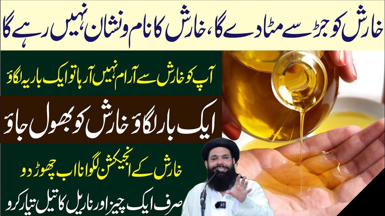 kharish ki Bimari khatam karne ka tarika | kharish Ka ilaj | kharish ka asan ilaj | Ubqari | Tasbeeh