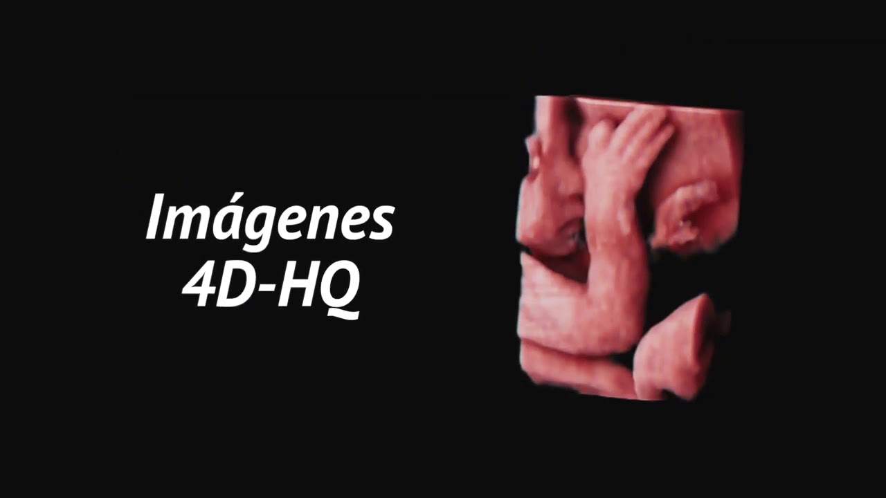 VINNO 6   ECOCARDIOGRAFO ECOGRAFO GAMA ALTA TOUCH SCREEN vision innovation