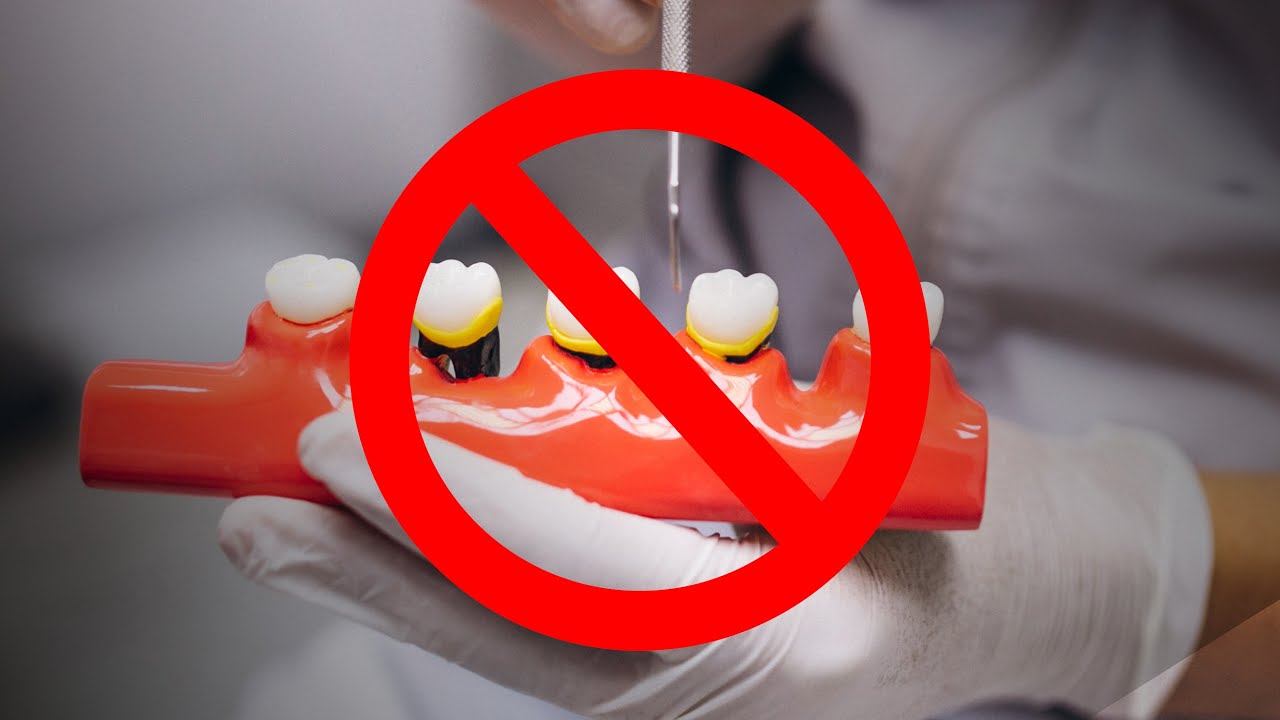 Putzen ist nicht gleich Putzen - Prophylaxe und Parodontitis