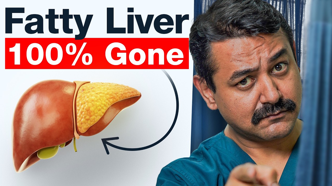 4 Week Plan To Reverse Fatty Liver Naturally (at ZERO COST)