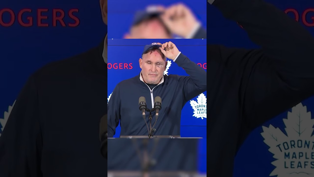 Toronto Maple Leafs Coach Craig Berube Reveals Nasty Scar From Gym Accident
