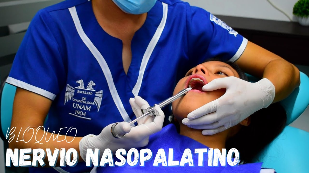 Técnicas de anestesia Nasopalatina/ Malamed
