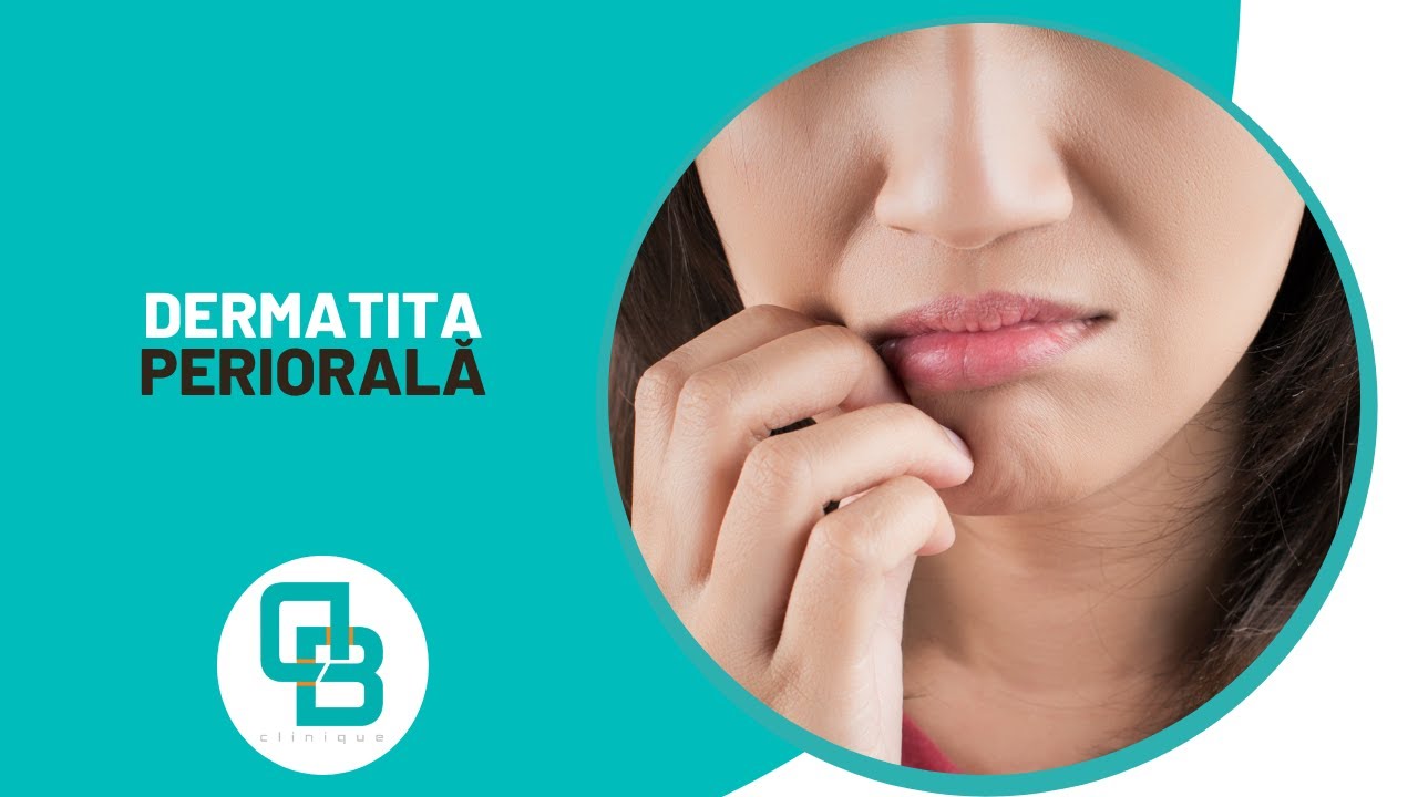 Dermatita periorala | DermaBeauty Clinique