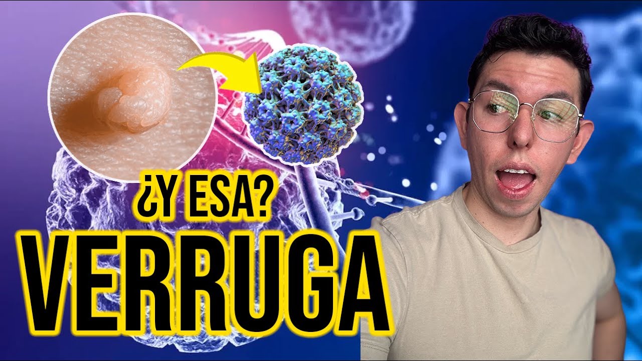 TODO sobre el VPH (Virus del papiloma humano) | DrPoloGuerrero