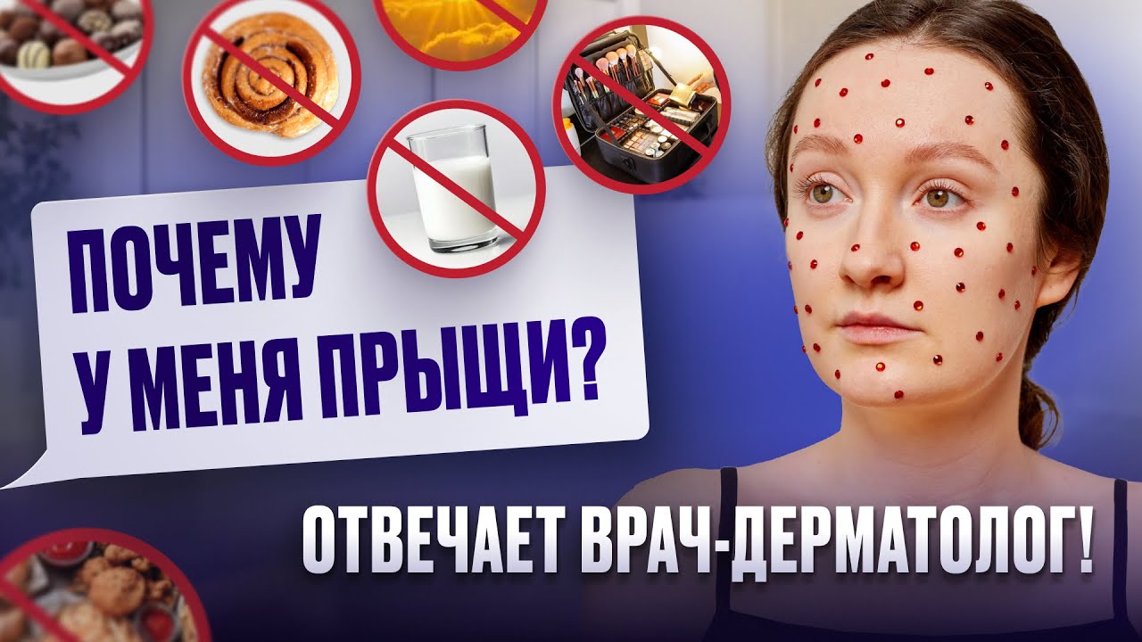 Говорим про акне: причины прыщей на лице у взрослых