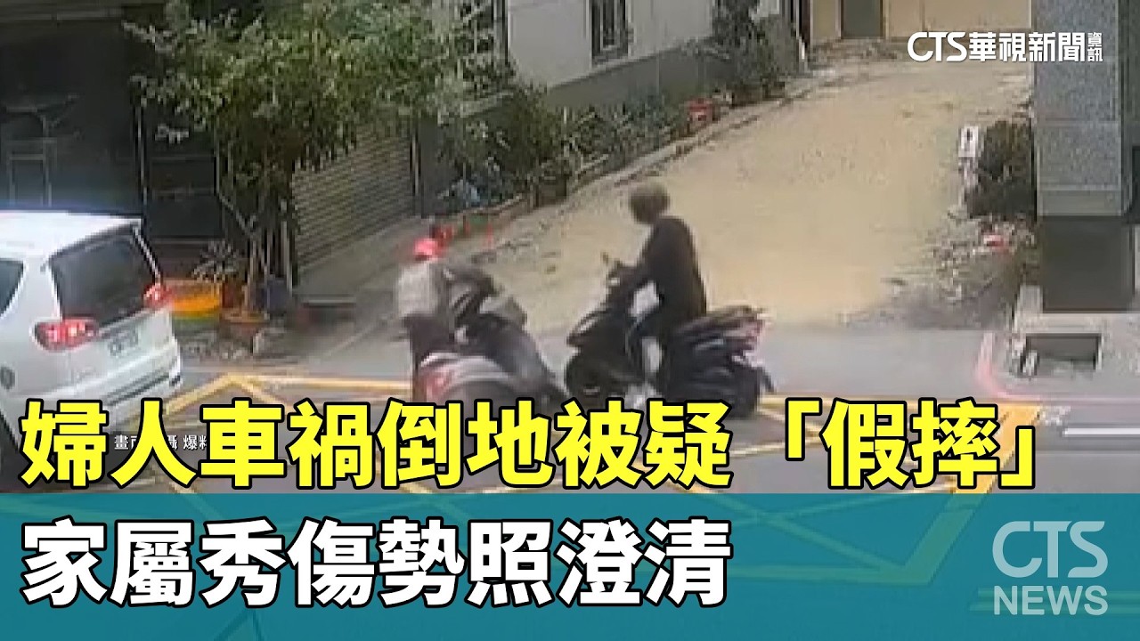 婦人車禍倒地被疑「假摔」　家屬秀傷勢照澄清｜華視新聞 20260225 @CtsTw