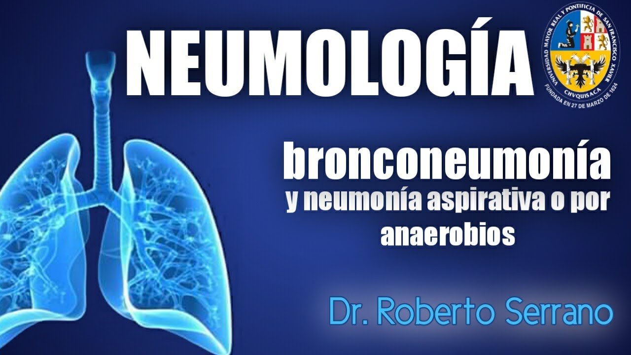 Bronconeumon&iacute;a y neumon&iacute;a aspirativa o por anaerobios - Neumolog&iacute;a Dr. Serrano