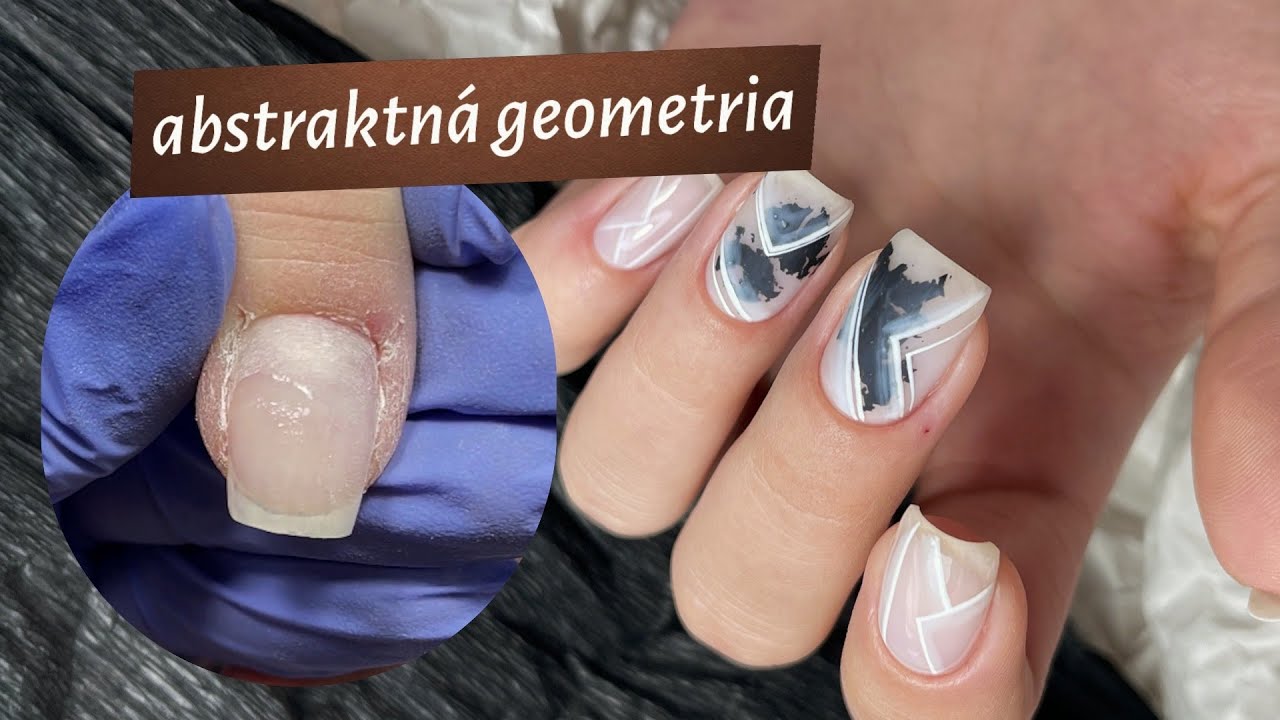 Suché ruky a zádery | Oľa galéria