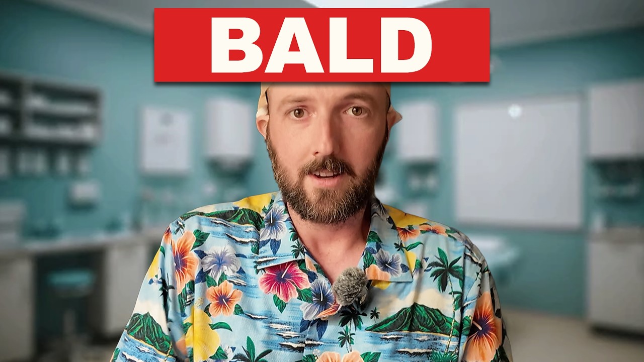 I Got a Hair Transplant In Mexico