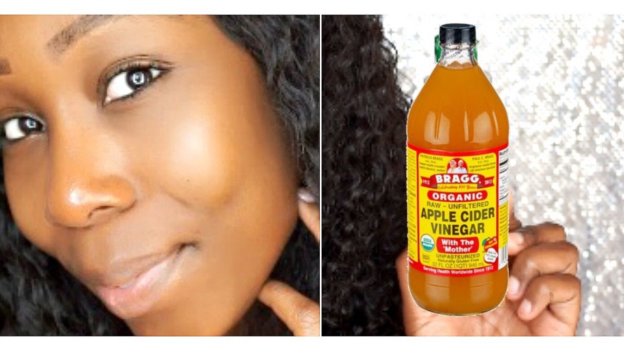 How To Get Clear Glowing Skin In 7 Days: DIY ACV Toner!