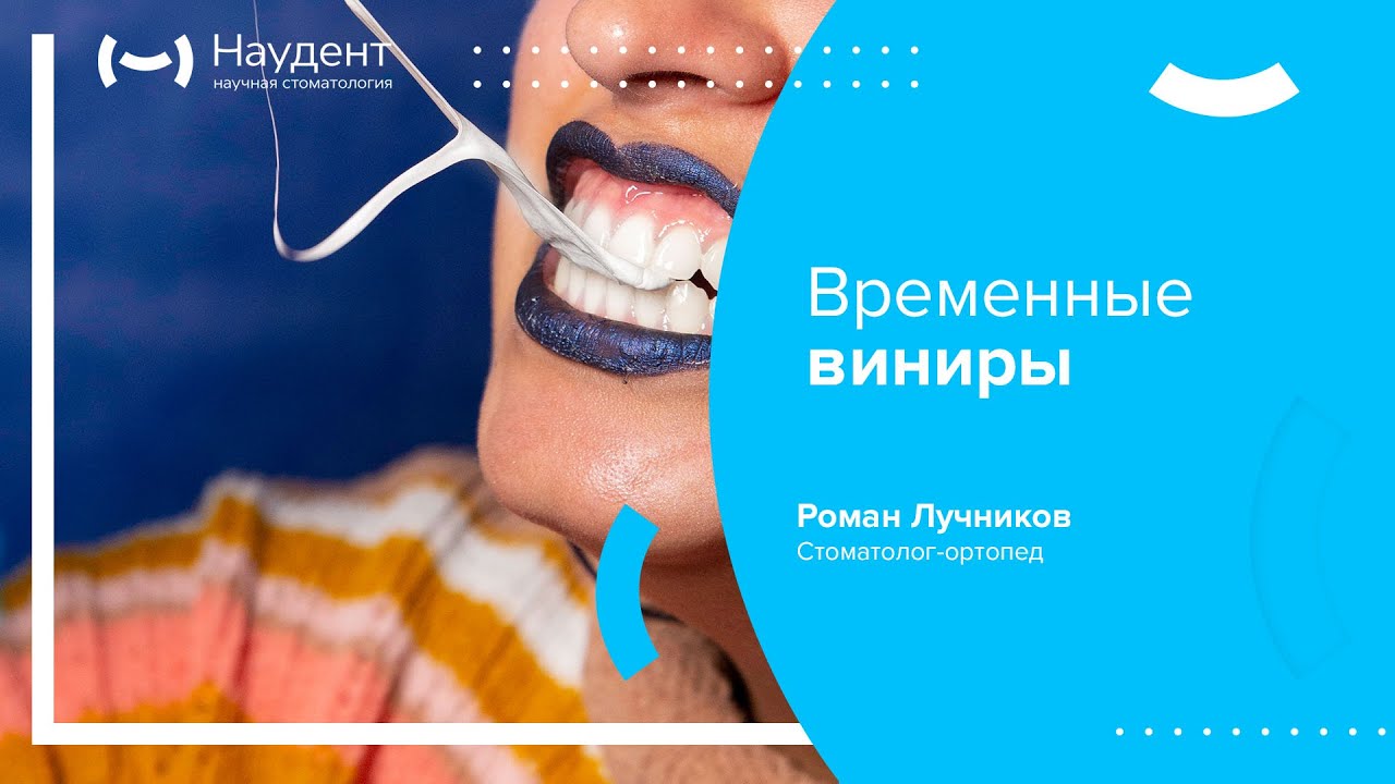🦷 Временные виниры