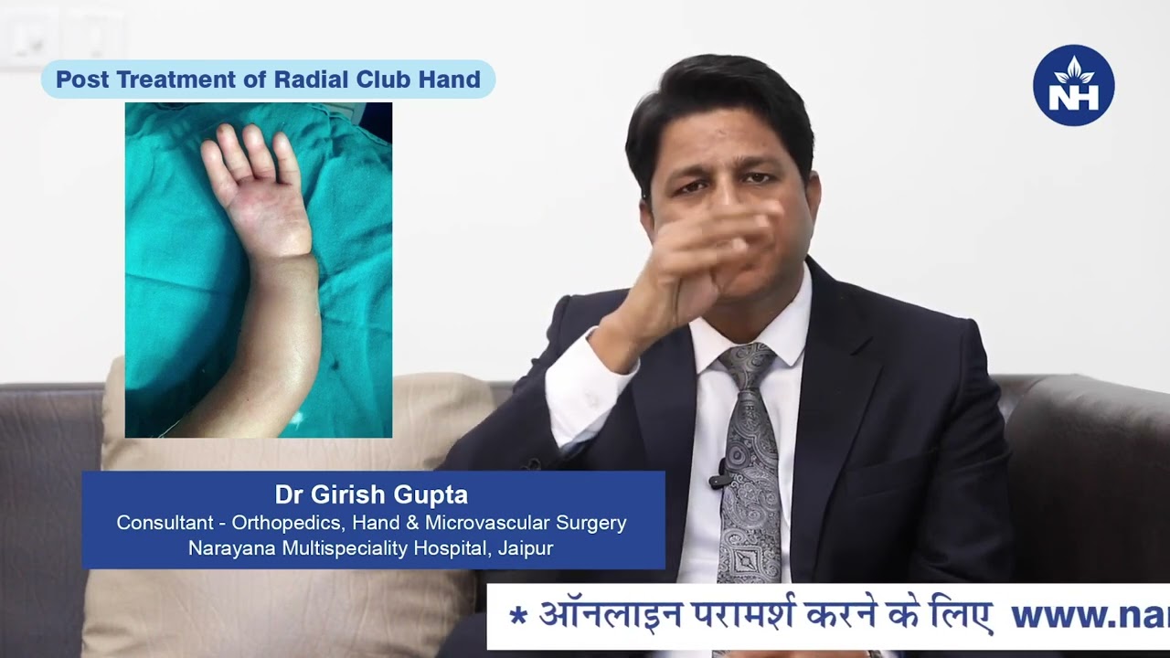 Radial Club Hand | Dr. Girish Gupta