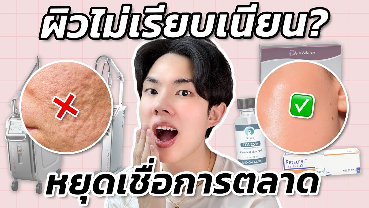 รักษาหลุมสิว ผิวไม่เรียบเนียนแบบเห็นผล ไม่ขายฝัน! สกินแคร์ เลเซอร์ ฟิลเลอร์ หัตถการ เลือกอะไรดีสุด?!