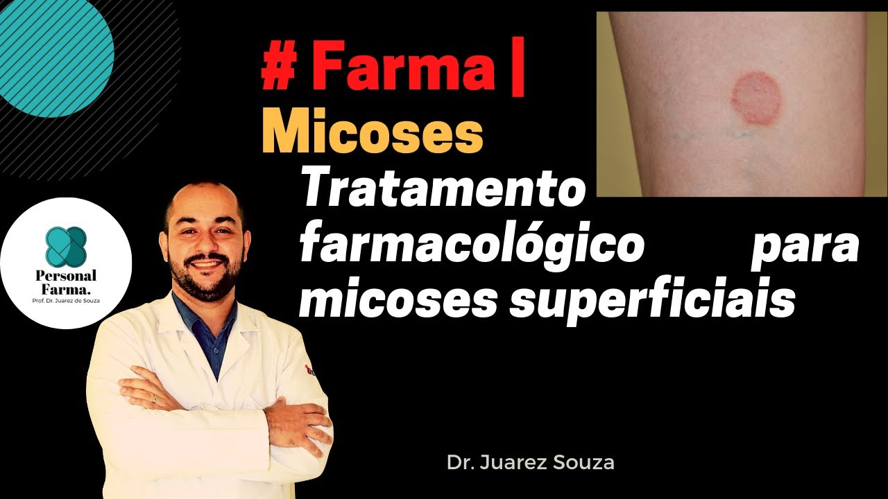 Farma | Tratamento Farmacol&oacute;gico de Dermatofitoses (Micoses Superficiais)