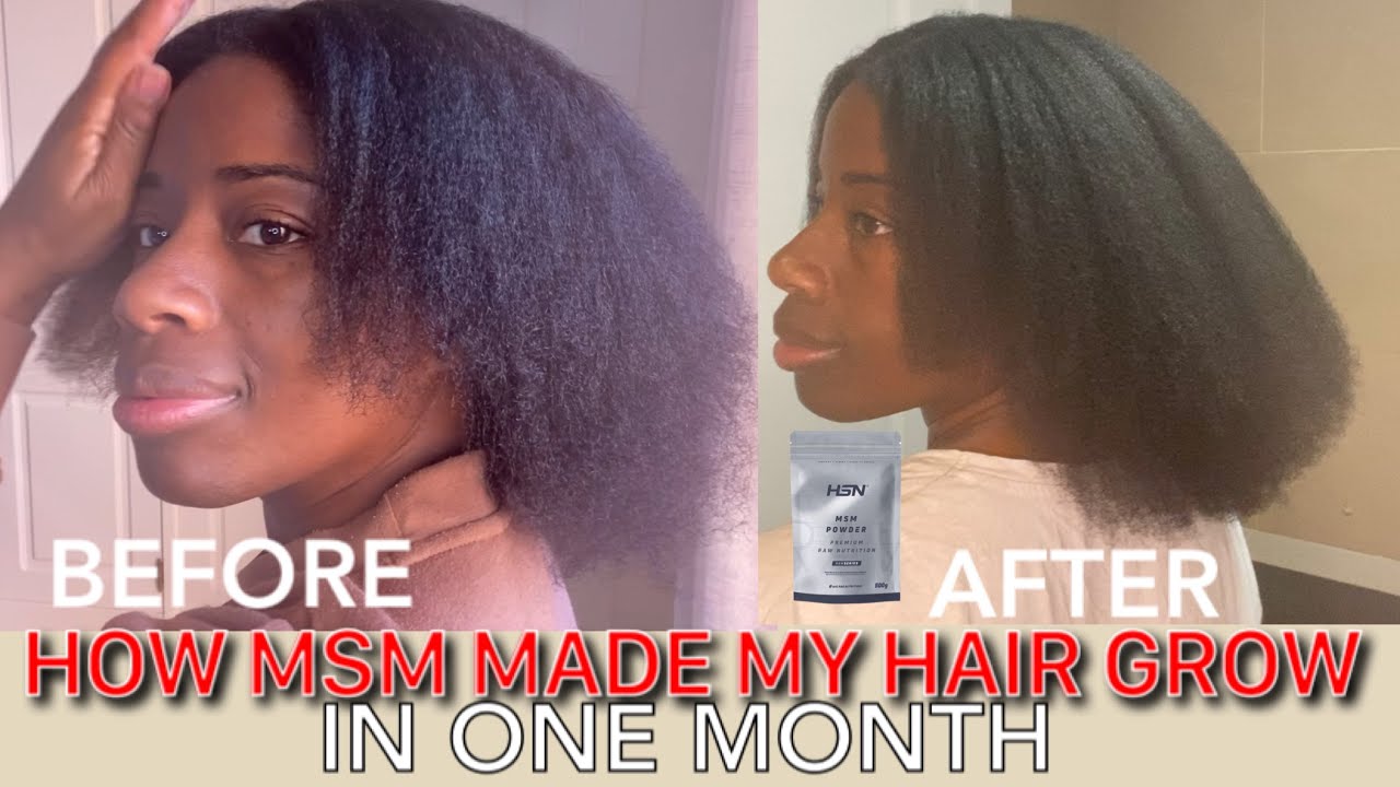 TRY THIS IF YOUR HAIR IS NOT GROWING| MSM Supplement & watch your HAIR TRANSFORM