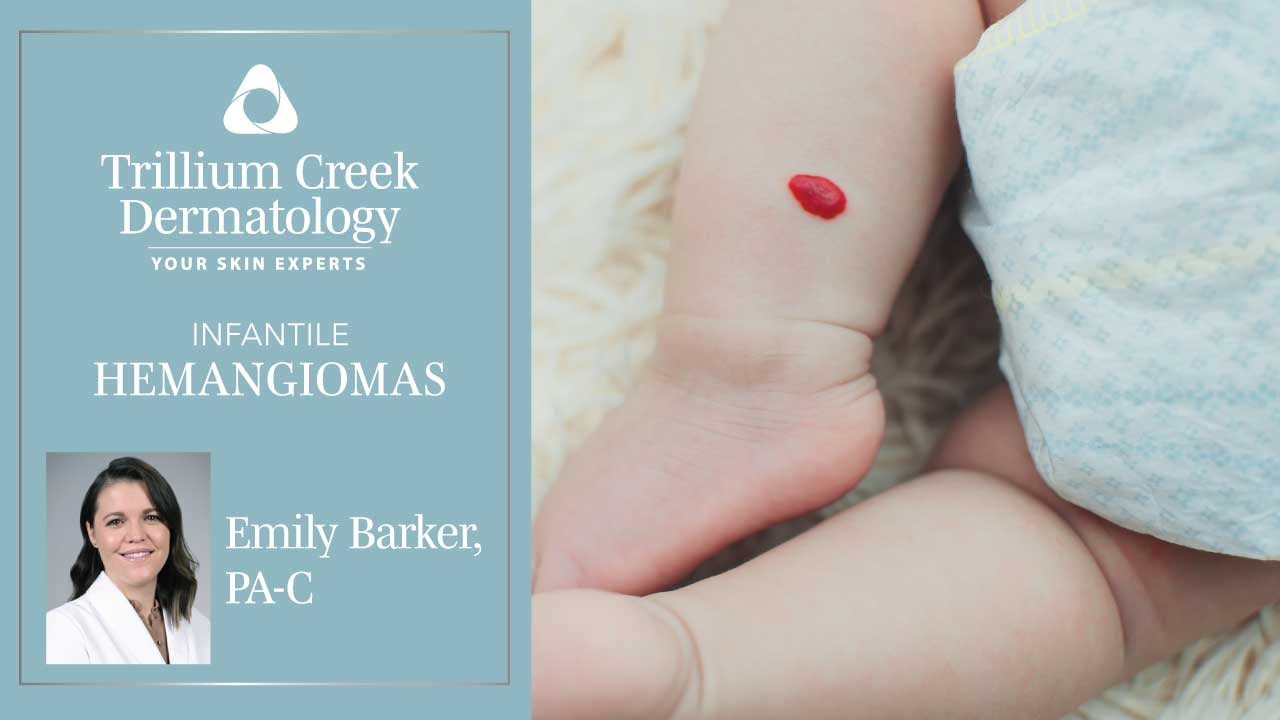 What are Infantile Hemangiomas?
