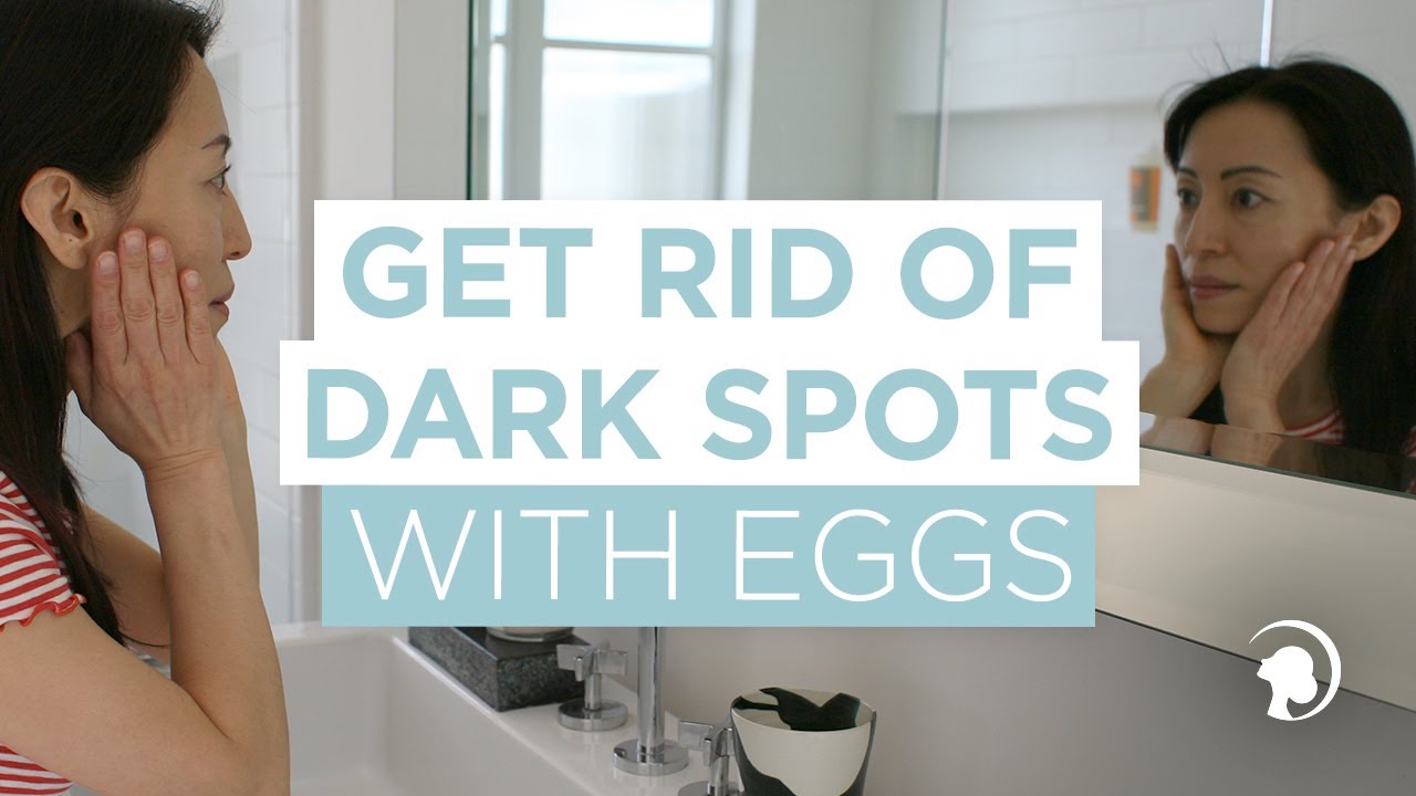 How to Get Rid of Dark Spots on the Face!