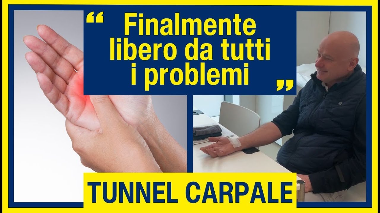 Intervento Tunnel Carpale - La testimonianza di Remo