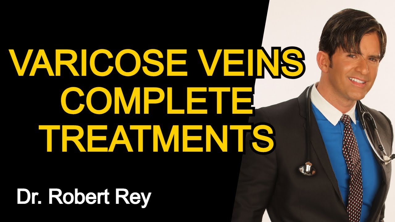VARICOSE VEINS COMPLETE TREATMENTS - Dr. Rey