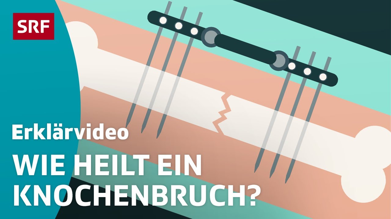 Knochen: Vom Aufbau zum Heilungsprozess &ndash; einfach erkl&auml;rt | Kindervideos | SRF Kids