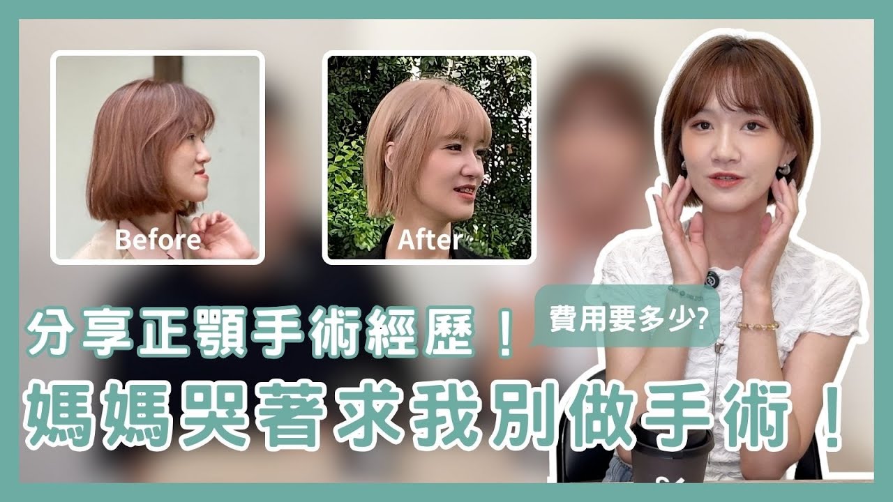 正顎手術費用要多少？媽媽哭著求我別做手術！分享戽斗改造經歷