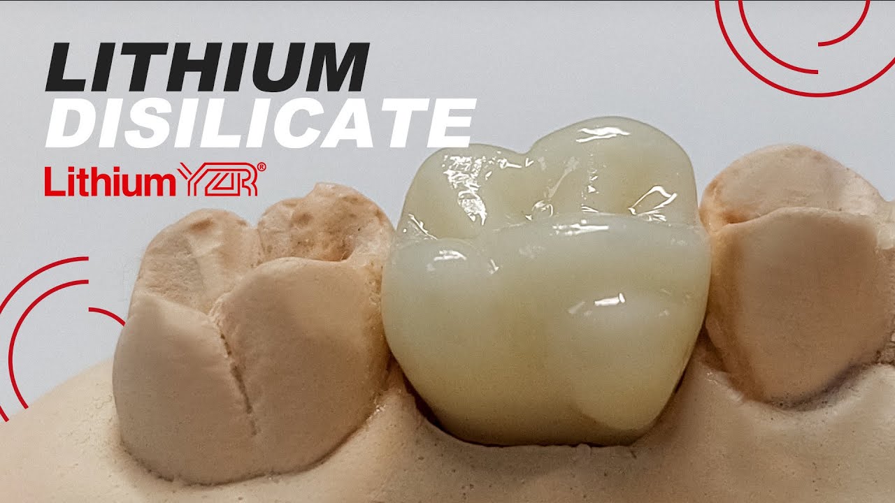 Lithium Disilicate dental crowns and copings (Lithium YZR®) #dental  #lithium #dentalcrowns