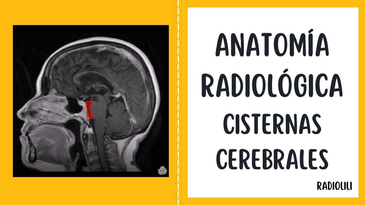 Anatomía Radiológica - Resonancia Magnética: Cisternas cerebrales.