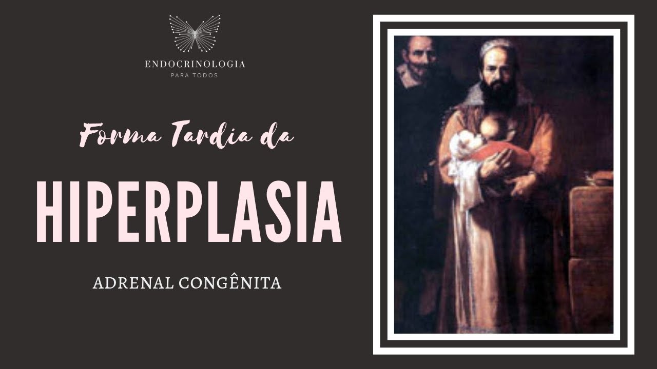 Hiperplasia Adrenal Congênita - Forma Tardia