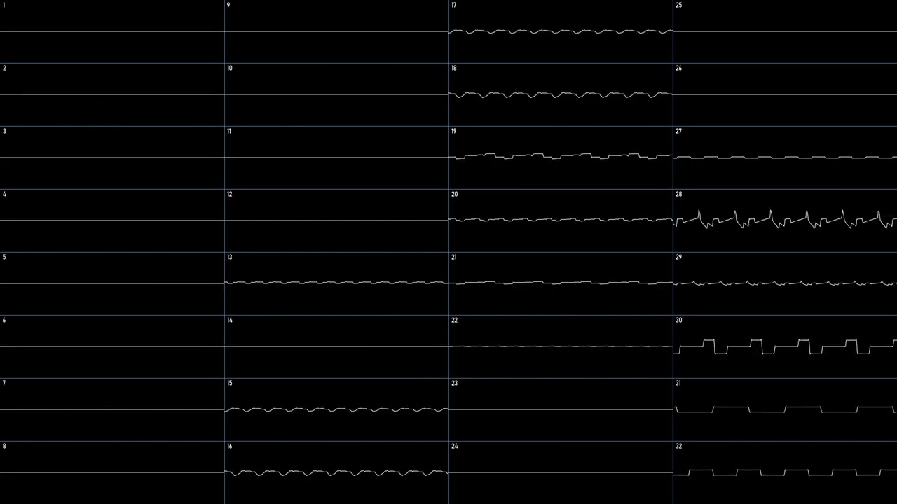 Papillons — Malmen & Xyce (Oscilloscope View/Visão do osciloscópio)