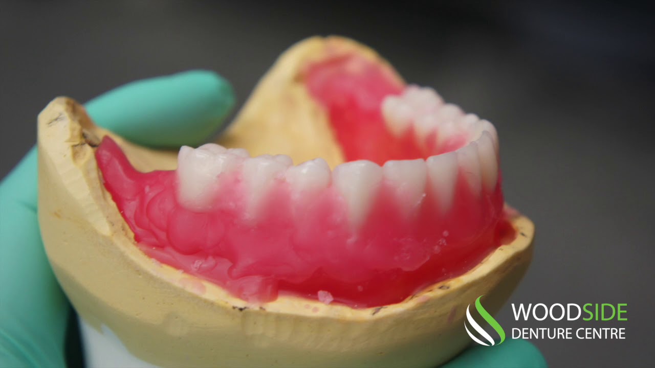 Step by Step of How Dentures Are Made
