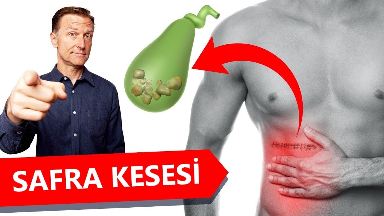 Safra kesesi olmazsa ne olur? | Dr.Berg Türkçe